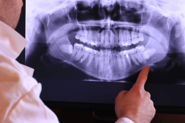 Best Chipped Tooth Repair Near Me  in Unionville, NC