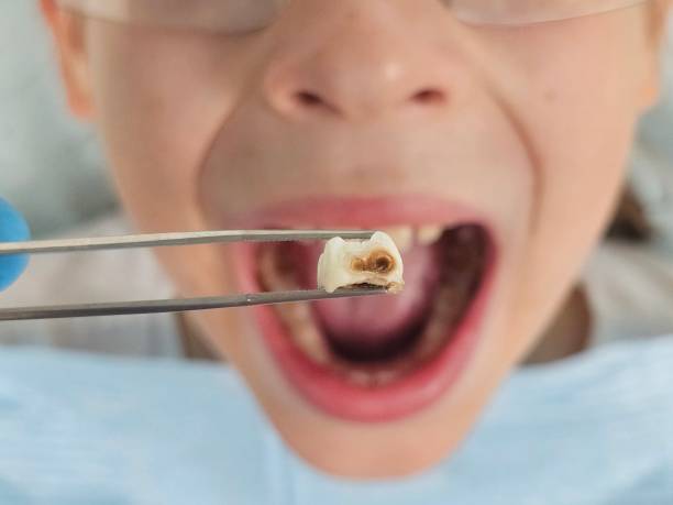 Best Broken Tooth Emergency  in Unionville, NC