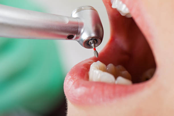 Best Tooth Infection Emergency Dentist  in Unionville, NC